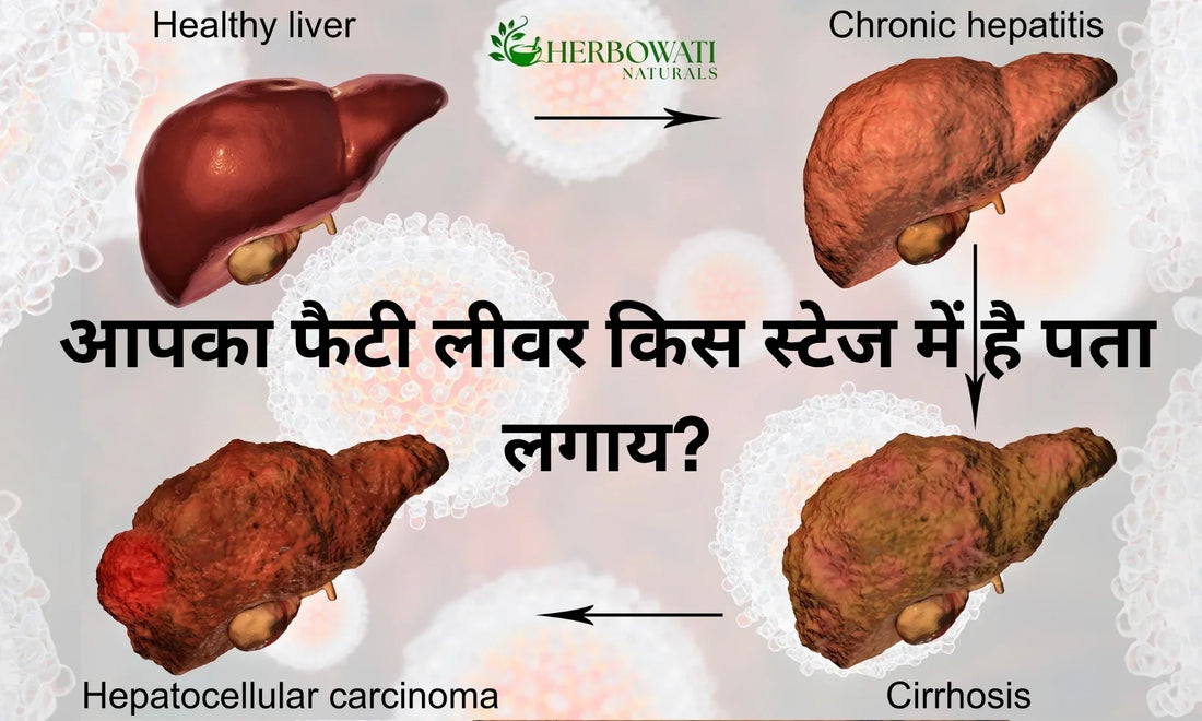🩸 Fatty Liver Disease — चारों ग्रेड की पूरी जानकारी