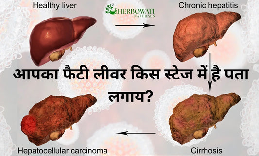 🩸 Fatty Liver Disease — चारों ग्रेड की पूरी जानकारी