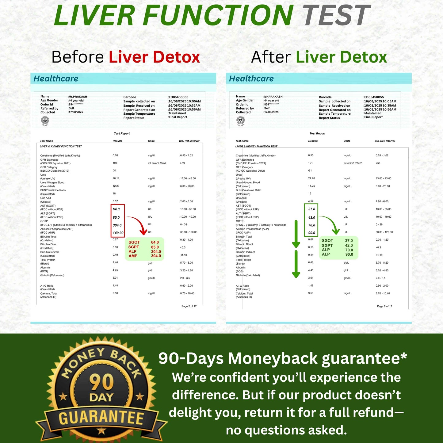 Liver Ultra detox - Best Ayurvedic medicine for fatty liver (Grade 1, 2 & 3)