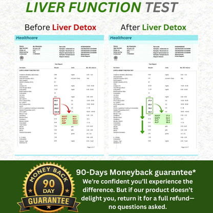 Liver Ultra detox - Best Ayurvedic medicine for fatty liver (Grade 1, 2 & 3)